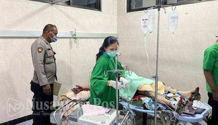 Gegara Ekonomi : Suami Bakar Istri Hingga Tewas di Banyuwang